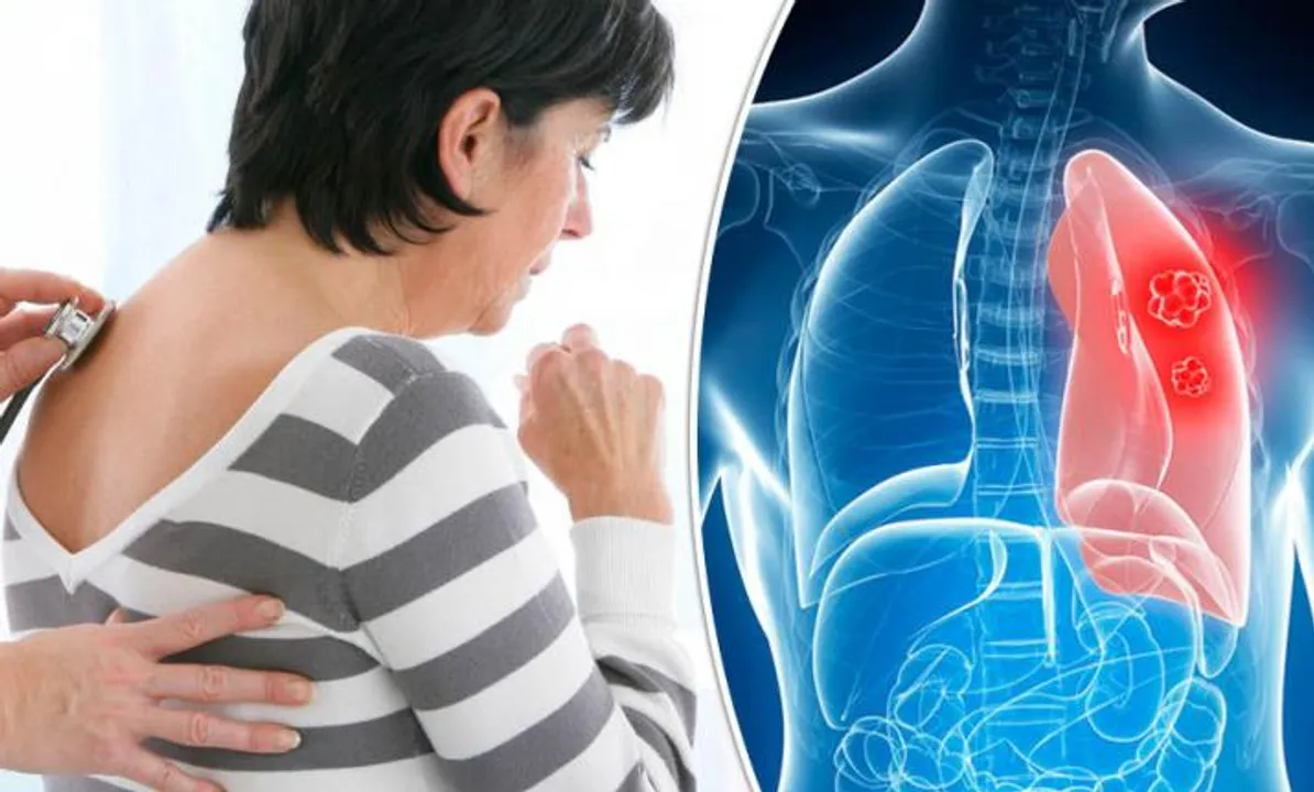  Lung Disease News 
