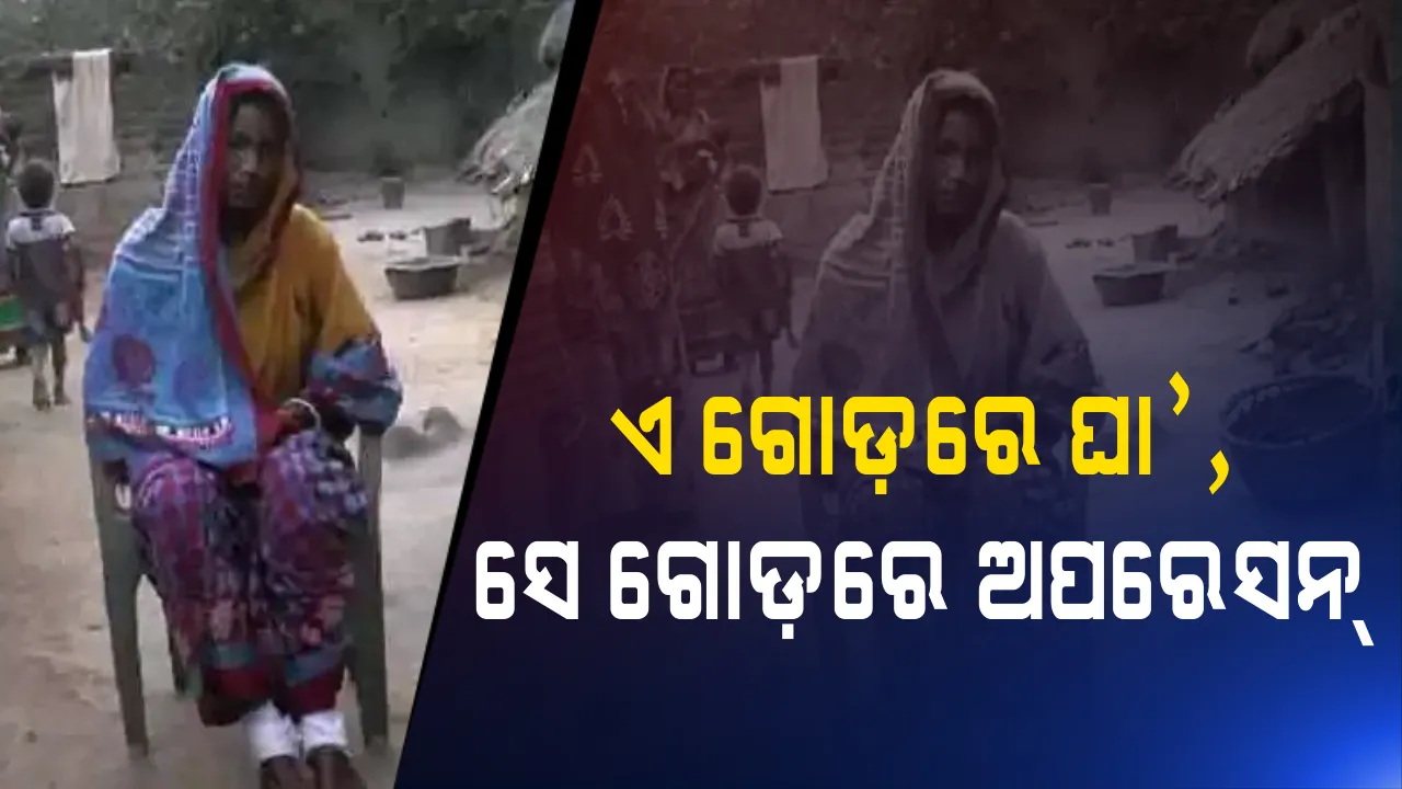  ଏମିତି ଡାକ୍ତରଙ୍କୁ ଦୁରୁଜୁହାର ! ଗୋଟିଏ ଗୋଡରେ ହୋଇଥିଲା ଘା, ଅନ୍ୟ ଗୋଡରେ କରିଦେଲେ ଅପରେସନ ।