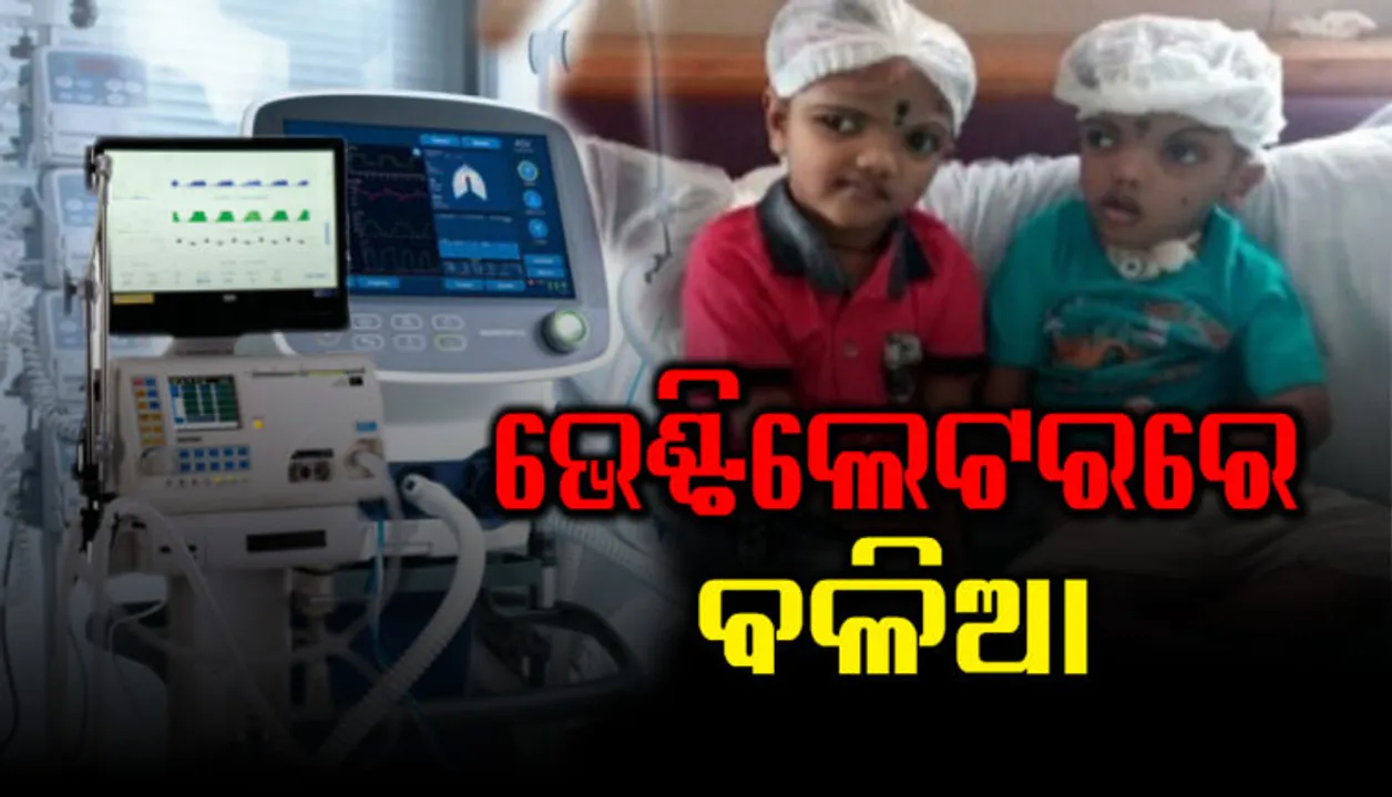  ଏମ୍ସ ପରାମର୍ଶରେ ବଳିଆର ହେଲା ରକ୍ତ ପରୀକ୍ଷା ! ୪ ଦିନ ହେଲାଣି ଭେଣ୍ଟିଲେଟରରେ ରହିଛି ବଳିଆ
