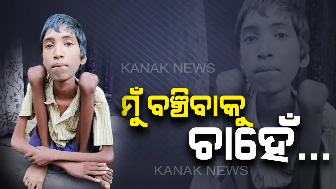  ଯନ୍ତ୍ରଣାରେ ଜୁଝୁଛି ୧୬ ବର୍ଷର ବାଳକ: ଡାକ୍ତରଙ୍କୁ ଦେଖାଇବାକୁ ବାପାମାଆଙ୍କ ପାଖରେ ନାହିଁ ସାମର୍ଥ୍ୟ..ସାହାଯ୍ୟ ଆଶାରେ କୁଳମଣି ମୁହଁରୁ ଭାସି ଆସୁଛି ଏକ ନୀରବ ସ୍ୱର...ମୁଁ ବଞ୍ଚିବାକୁ ଚାହେଁ