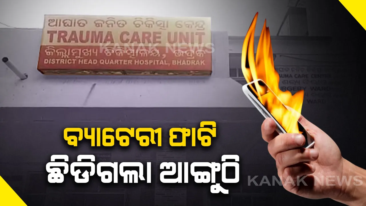  ବ୍ୟାଟେରୀ ଫାଟି ଛିଡିଗଲା ୩ ଆଙ୍ଗୁଠି । ବ୍ୟାଟେରୀରେ ତାର ସଂଯୋଗ କରି ଖେଳୁଥିଲା ନାବାଳକ, ଗୁରୁତର ଅବସ୍ଥାରେ ଡାକ୍ତରଖାନାରେ ଭର୍ତ୍ତି ।