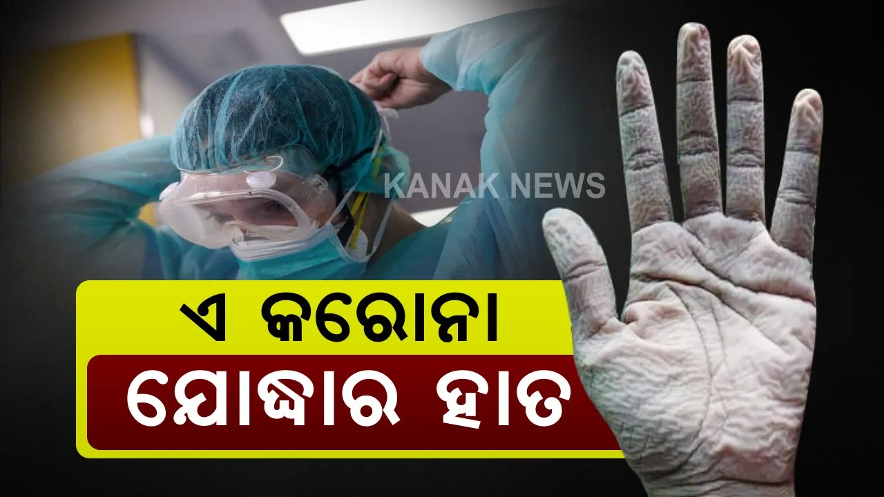 କରୋନା ଯୋଦ୍ଧାଙ୍କ କୁଞ୍ଚନ ହାତ : ଏହା କୌଣସି ସାମାନ୍ୟ ହାତ ନୁହଁ , ୧୦ ଘଣ୍ଟା ପ୍ରୋଟେକ୍ଟିଭ୍ ଗିୟର୍ ଭିତରେ ରହି ଡ଼୍ୟୁଟି କରିଥିବା କରୋନା ଯୋଦ୍ଧାର ହାତ । 