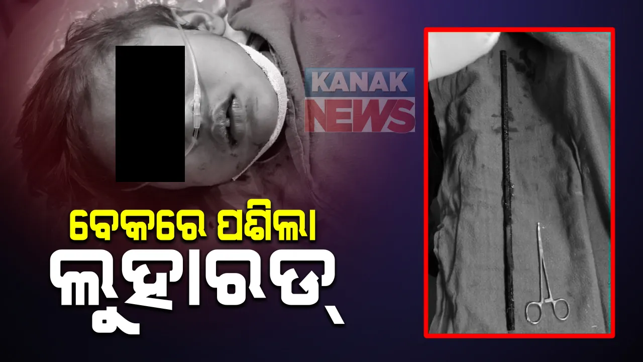  ଛାତରେ ଖେଳୁଥିବା ବେଳେ ଅଘଟଣ : କୁନି ଶିଶୁର ବେକରେ ପଶିଗଲା ଲୁହା ରଡ, ଏମକେସିଜିରେ ଅସ୍ତ୍ରୋପଚାର କରି ବାହାର କରାଗଲା ଲୁହା ରଡ; ଡାକ୍ତରୀ ଦଳକୁ ଶୁଭେଚ୍ଛା ଜଣାଇଲେ ଜିଲ୍ଲାପାଳ