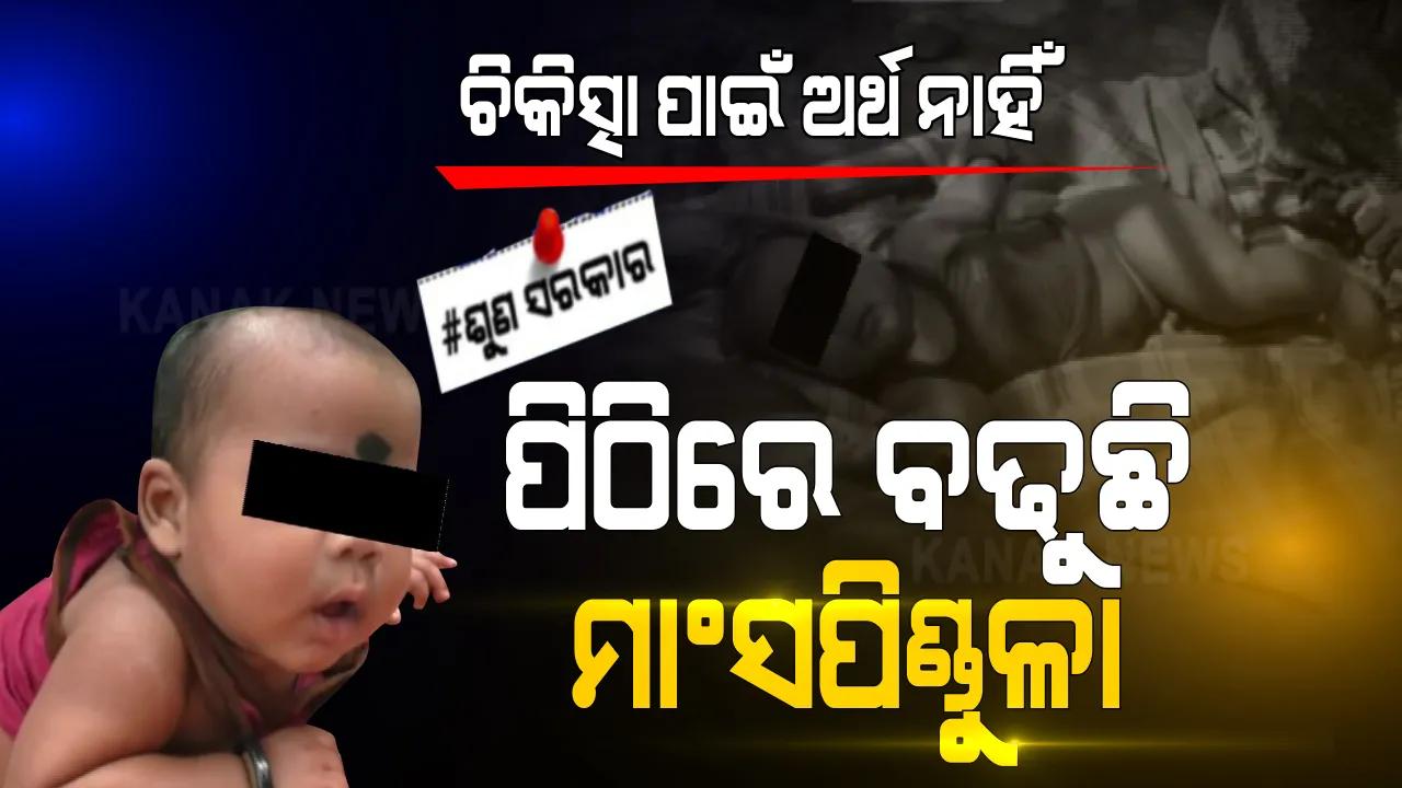  ଚିକିତ୍ସା ପାଇଁ ପୁଣି ବାଧକ ସାଜିଲା ଟଙ୍କା । ୬ ମାସ ଶିଶୁ ପୁତ୍ର ପିଠିରେ ଅସ୍ୱାଭାବିକ ଭାବରେ ବଢିଚାଲିଛି ମାଂସ ପିଣ୍ଡୁଳା, ସରକାରୀ ସହାୟତା ଦେବାକୁ ଗୁହାରି କରୁଛି ପରିବାର