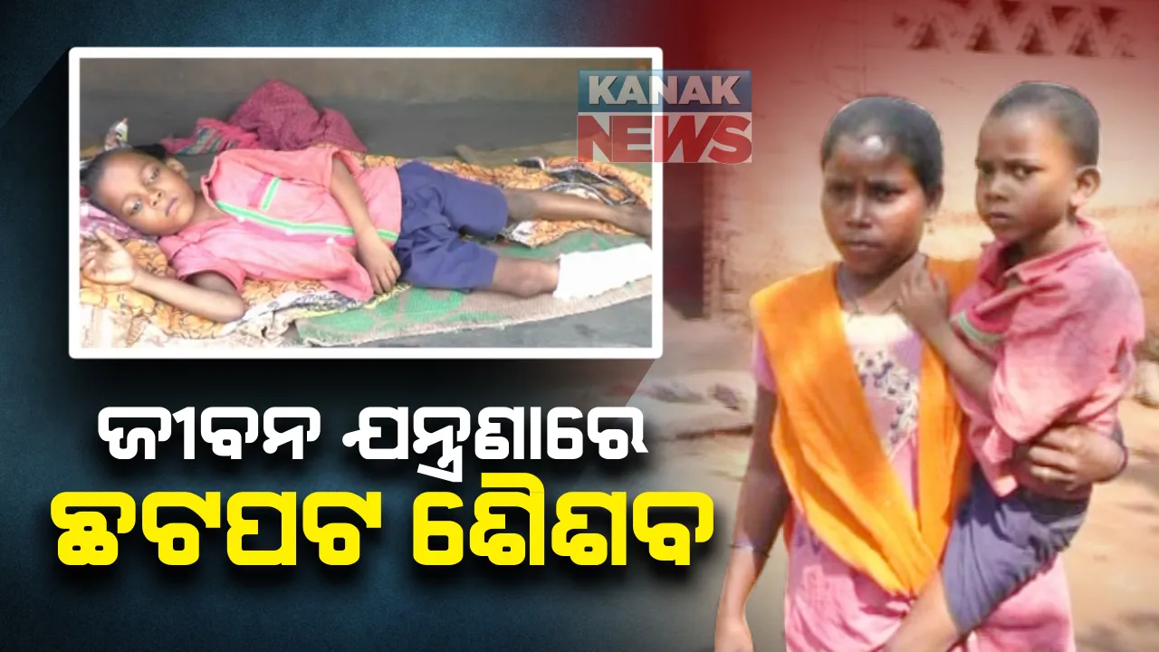  ଜୀବନ ଯନ୍ତ୍ରଣାରେ ଛଟପଟ ହେଉଛି ୫ବର୍ଷର ଶିଶୁ : ଉପଯୁକ୍ତ ଚିକିତ୍ସା ଅଭାବରୁ ବଢିଚାଲିଛି ଜୱାର ବାଦ୍ରାର କଷ୍ଟ; ଚିକିତ୍ସା ପ୍ରତିଶ୍ରୁତି ଦେଲେ ଦାନଗଦି ବିଡିଓ 