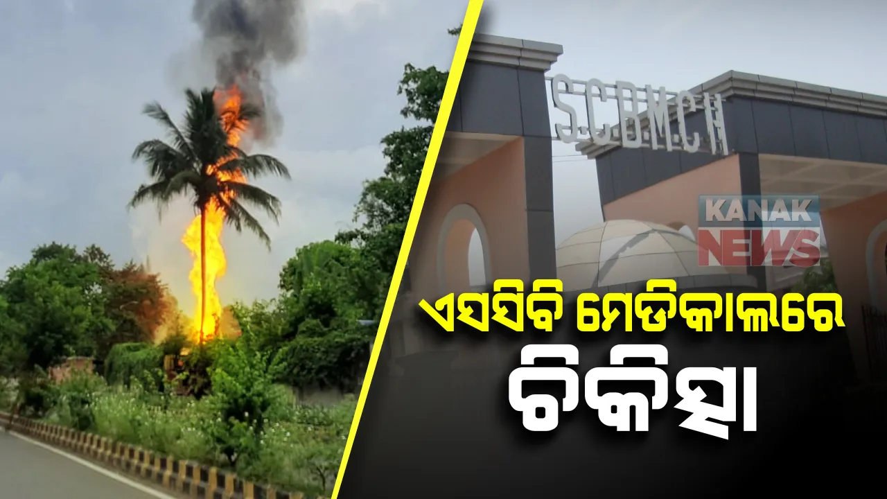  କଟକ ବଡମେଡିକାଲରେ ଚାଲିଛି ପେଟ୍ରୋଲ ପମ୍ପ ଦୁର୍ଘଟଣାର ଦୁଇ ଗୁରୁତରଙ୍କ ଚିକିତ୍ସା । ୪୦ରୁ ୬୦ ପ୍ରତିଶତ ପୋଡିଯାଇଛି ଶରୀର, ମୁଣ୍ଡରେ ଲାଗିଛି ଶକ୍ତ ଆଘାତ, ଜଣଙ୍କର ଗୋଟିଏ ଆଖି ନଷ୍ଟ