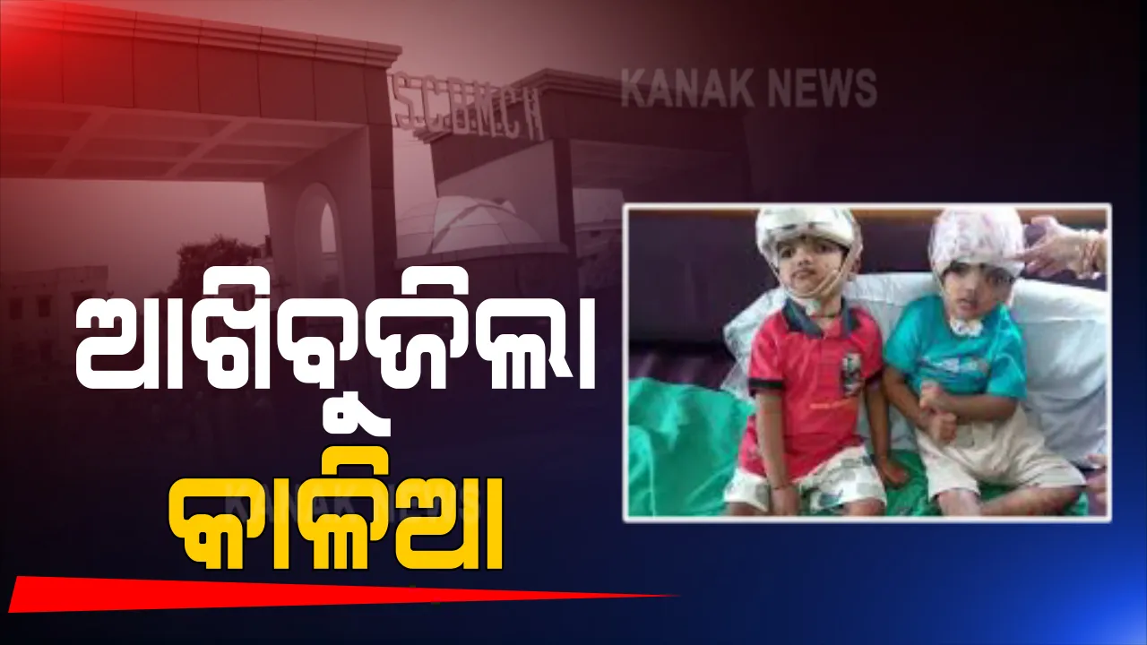  କଟକ ଏସସିବିରେ ଆଖିବୁଜିଲା ଯୋଡାମୁଣ୍ଡ ଶିଶୁ କାଳିଆ । ସେପ୍ଟିମିସିଆ ଯୋଗୁଁ କାଳିଆର ମୃତ୍ୟୁ 