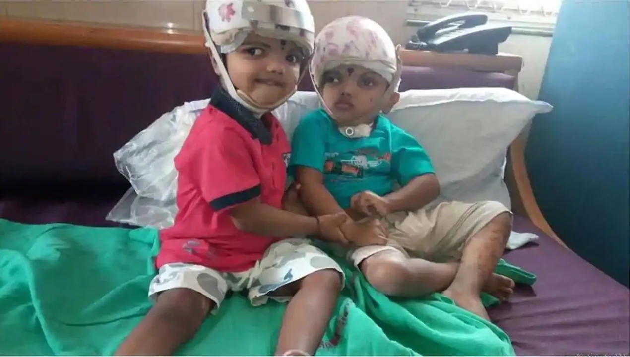  ୧୨ ମାସ ସଂଘର୍ଷର ଅନ୍ତ : ଜଗାକୁ ଛାଡ଼ି ଚାଲିଗଲା ବହୁଚର୍ଚ୍ଚିତ କନ୍ଧମା‌ଳର ଯୋଡ଼ାମୁଣ୍ଡ ଶିଶୁ କାଳିଆ