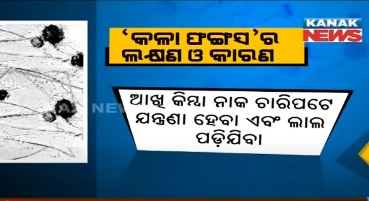  କେମିତି କରିବେ କଳା ଫଙ୍ଗସର ମୁକାବିଲା ? ଆଡଭାଇଜରୀ ଜାରି କଲା ଆଇସିଏମଆର, ନଜର ପକାନ୍ତୁ ‘କଳା ଫଙ୍ଗସ’ର ଲକ୍ଷଣ ଓ କାରଣ ଉପରେ ।