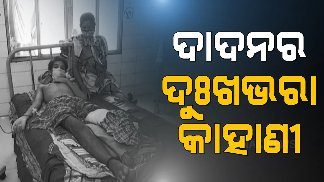  ପେଟ ପାଇଁ ନାବାଳକ ଯାଇଥିଲେ ଦାଦନ ଖଟି । ଚେନ୍ନାଇରୁ ଯନ୍ତ୍ରଣା ନେଇ ଫେରିଲେ ସିଫନ୍ ମଲ୍ଲିକ । ଟ୍ରେନ ଦୁର୍ଘଟଣାରେ ଗୋଟିଏ ଗୋଡ କଟି ଯିବା ପରେ ମେଡିକାଲ ବେଡରେ କଟୁଛି ଯନ୍ତ୍ରଣାପୂର୍ଣ୍ଣ ଜୀବନ ।