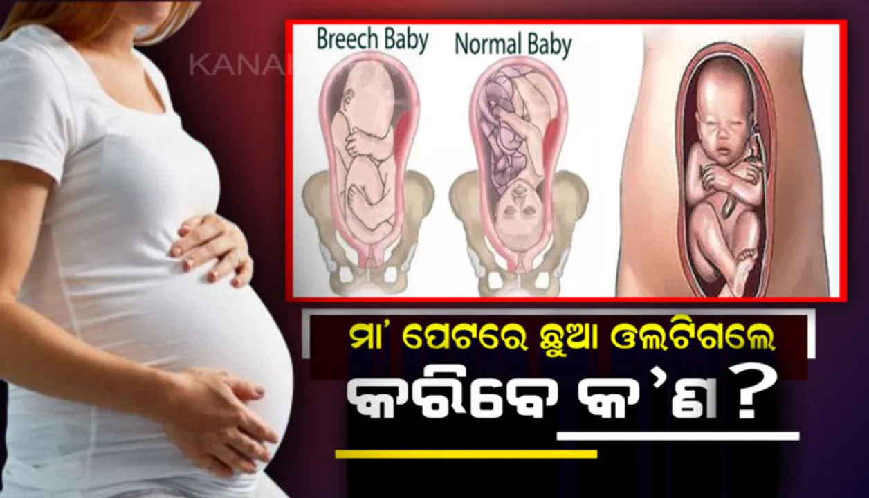  ଗର୍ଭବତୀ ମହିଳାଙ୍କ ପେଟରେ ଛୁଆ ଓଲଟିଗଲେ କରିବେ କ’ଣ? ଜାଣିରଖନ୍ତୁ