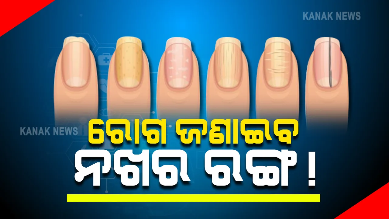  ନଖର ରଙ୍ଗ ପରିବର୍ତ୍ତନ କେଉଁ ରୋଗକୁ କରେ ଆମନ୍ତ୍ରଣ ? ନଖର ରଙ୍ଗ ଜଣାଇବ ଆପଣଙ୍କୁ ହୋଇଛି କେଉଁ ରୋଗ !