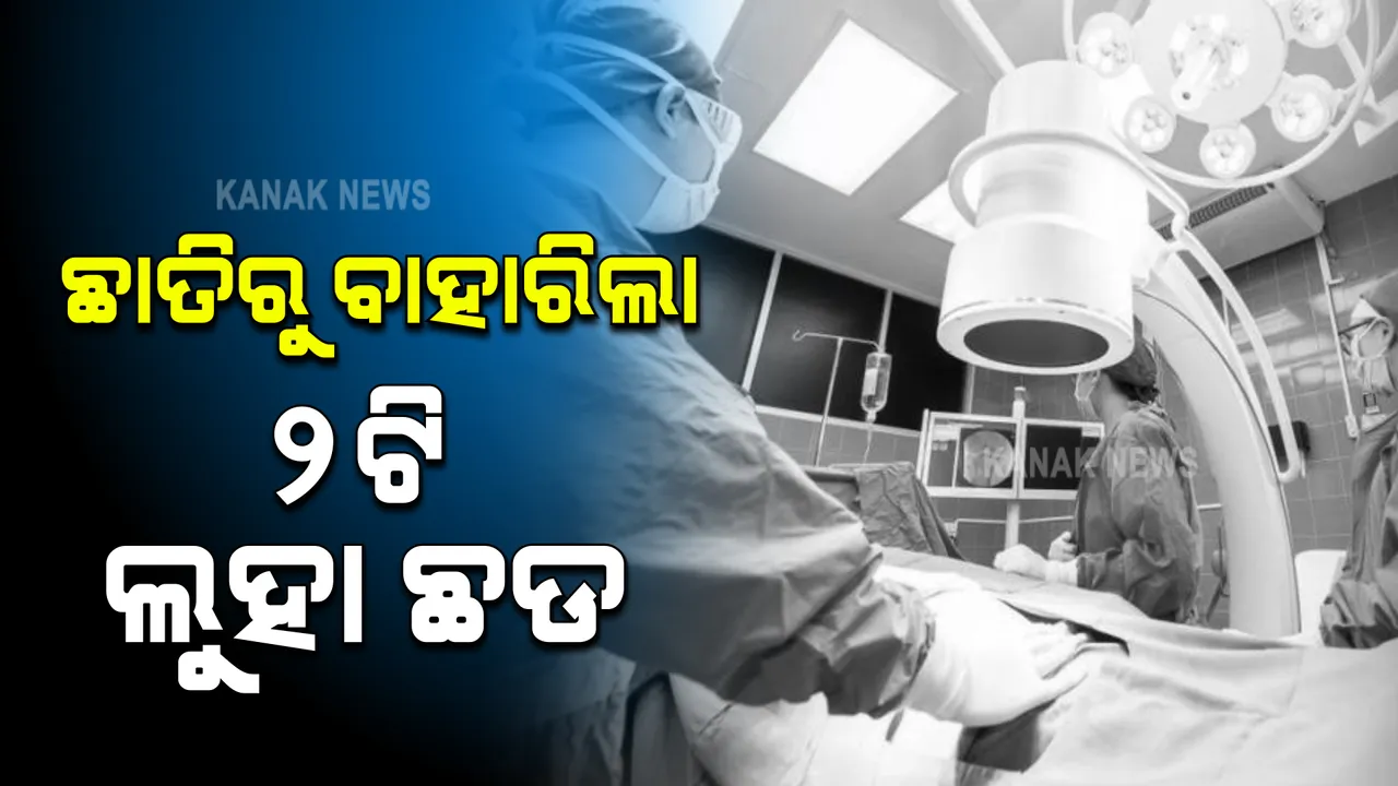  ୫ ଘଣ୍ଟାର ଅସ୍ତ୍ରୋପଚାର  । ଛାତିରୁ ବାହାରିଲା ୨ଟି ଲୁହା ଛଡ ।