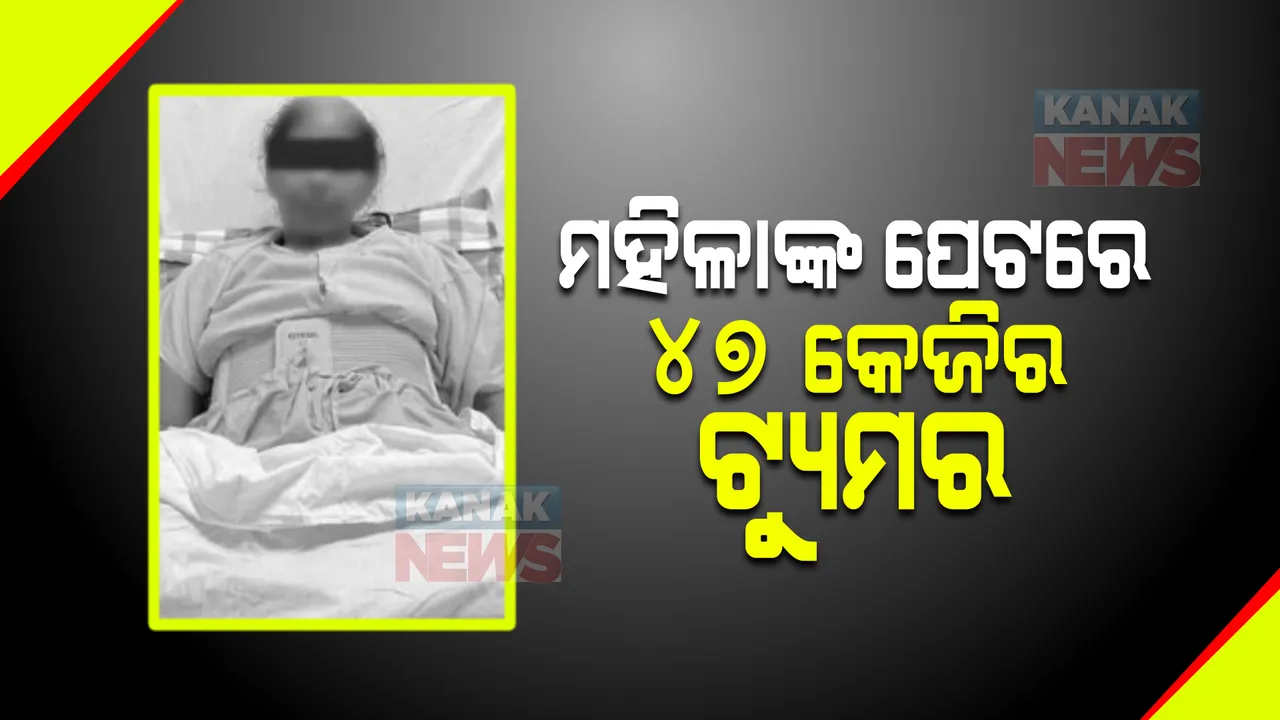  ପରିବାର ଲୋକେ ଭାବୁଥିଲେ ଗ୍ୟାସ ପାଇଁ ପେଟ ଫୁଲିଛି, ହେଲେ ଡାକ୍ତର ଦେଖିବା ପରେ ହୋଇଗଲେ ଆଶ୍ଚର୍ଯ୍ୟ