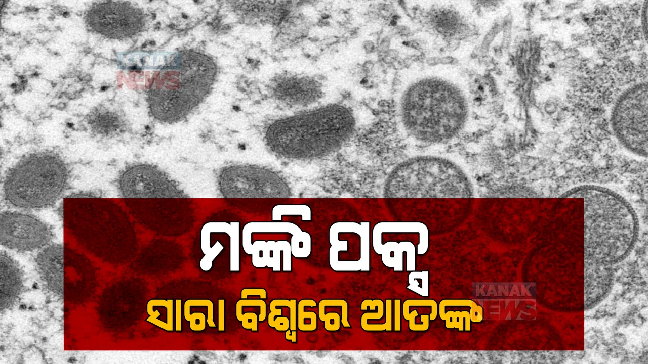  ଆତଙ୍କ ସୃଷ୍ଟି କରିଛି ନୂଆ ଭୂତାଣୁ ମଙ୍କିପକ୍ସ । ୧୧ଟି ଦେଶରୁ ୮୦ରୁ ଅଧିକ ମାମଲା ଚିହ୍ନଟ
