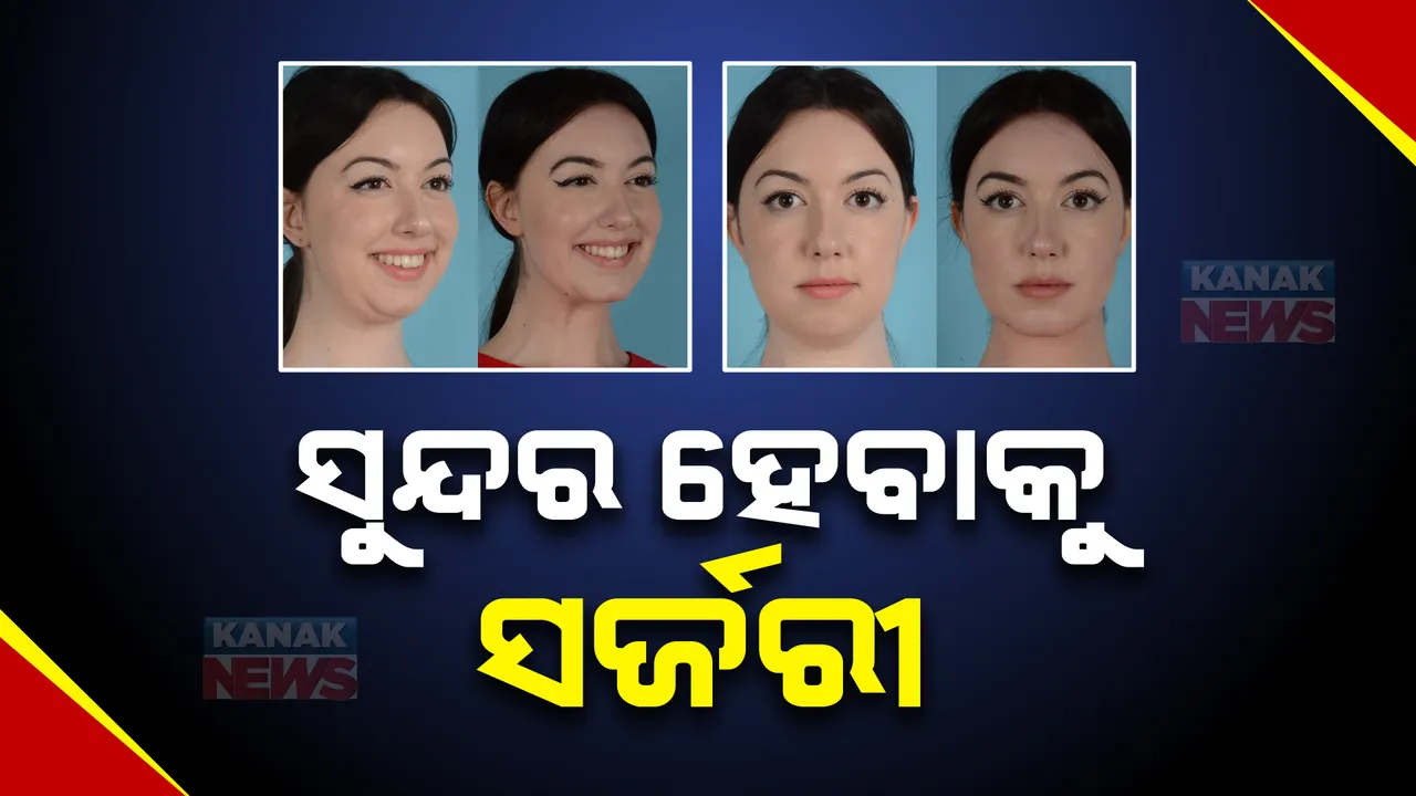 ଆଜି ବିଶ୍ୱ ପ୍ଲାଷ୍ଟିକ୍ ସର୍ଜରୀ ଦିବସ : ଜାଣନ୍ତୁ କସ୍ମେଟିକ୍ ସର୍ଜରୀର ଲାଭ ଓ କ୍ଷତି