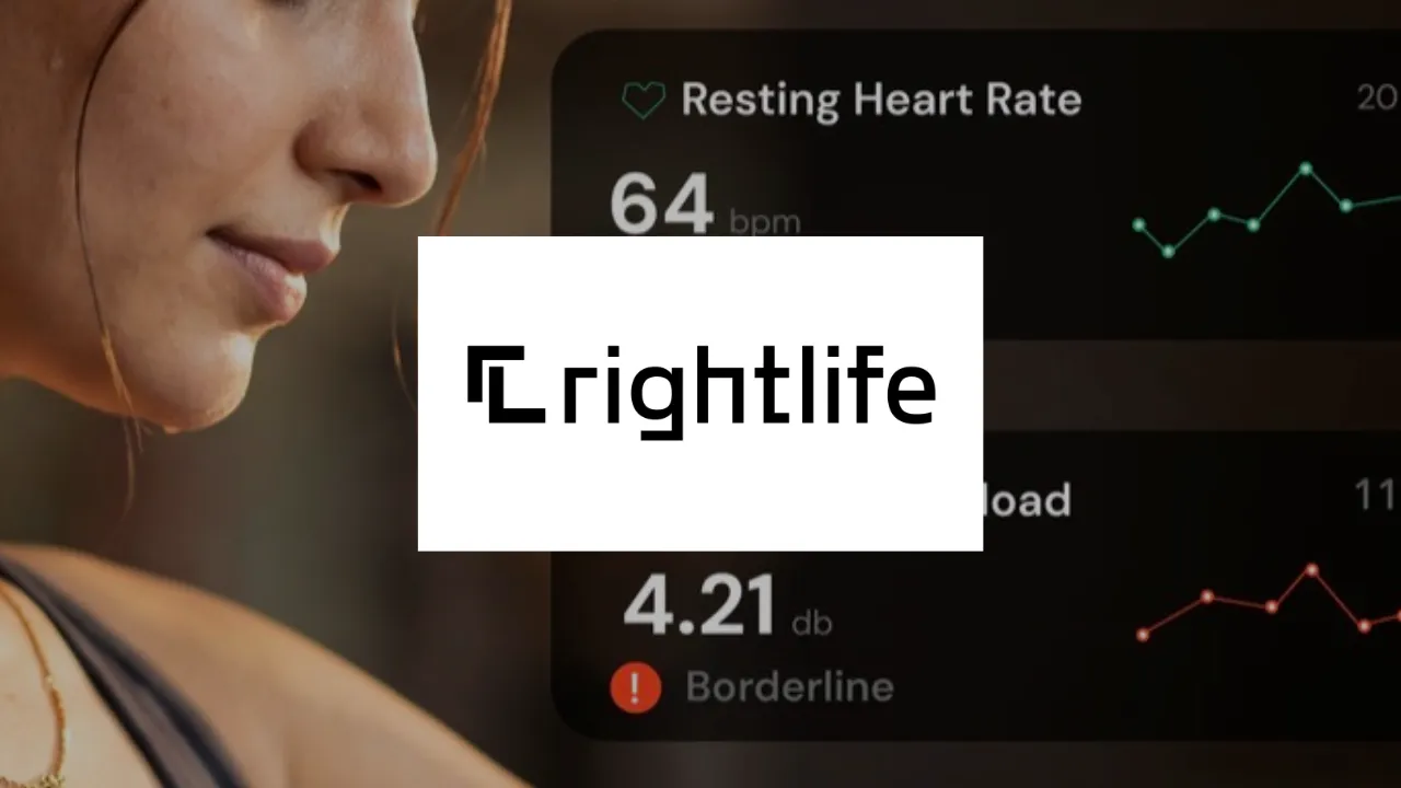Copy of Local Samosa FI - 1