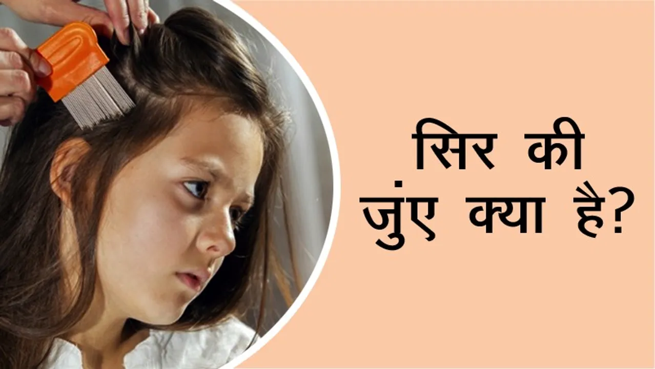 What is head lice? What are its symptoms and treatment
