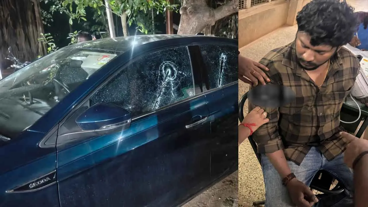  திமுக வழக்கறிஞர் மகனுக்கு அரிவாள் வெட்டு!