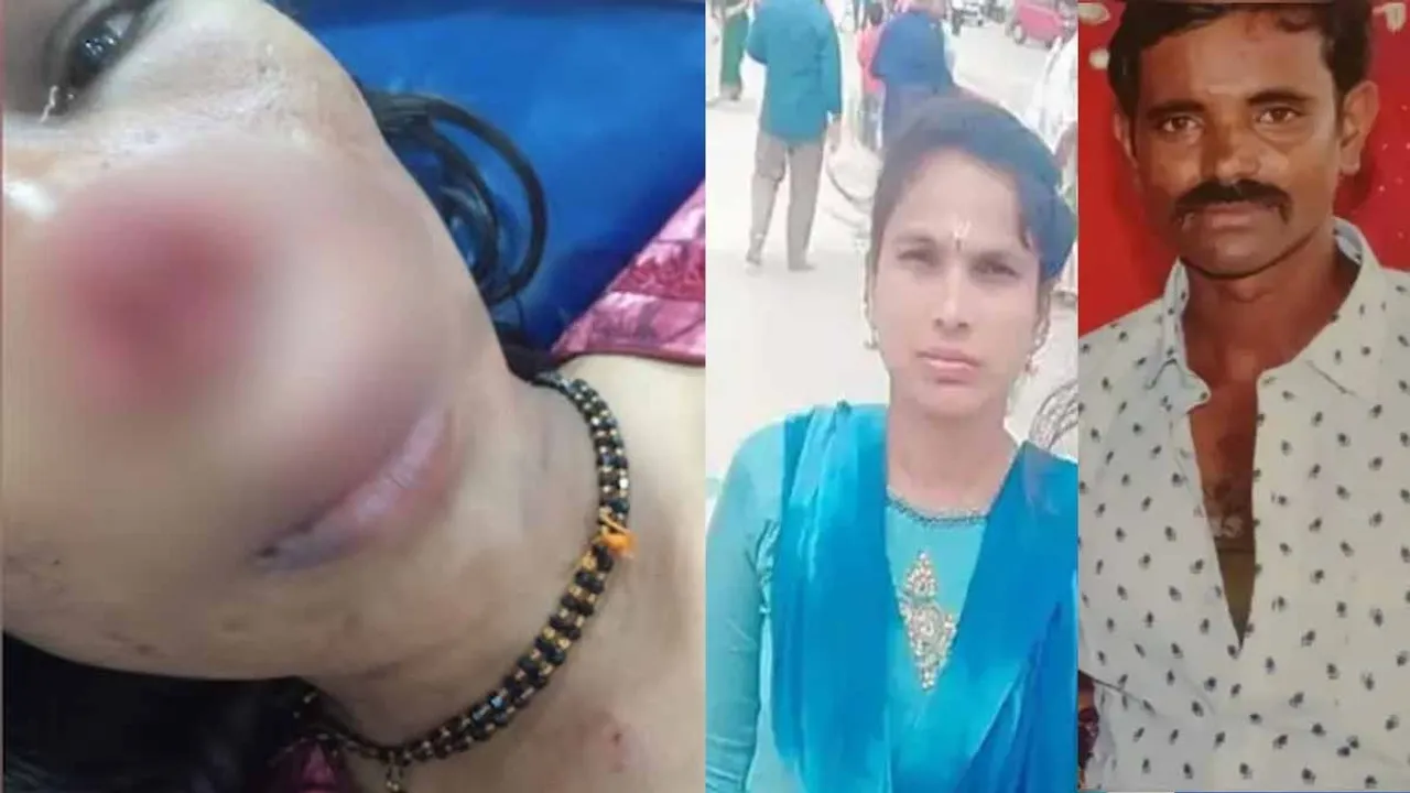  Husband bites wife's nose and spits it out Photograph: (karnataka) 
