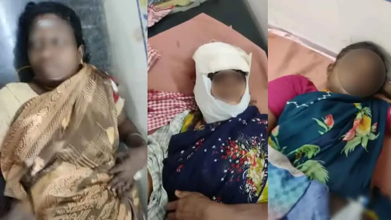  கரடி தாக்கி 3 பெண்கள் படுகாயம்; தென்காசியில் அதிர்ச்சி சம்பவம்!
