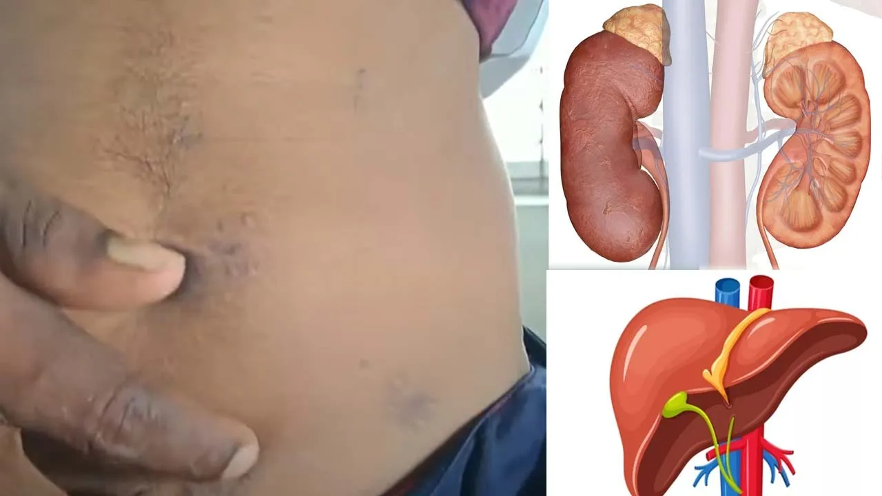  Following kidney theft, liver theft - the next shock in Namakkal Photograph: (namakkal) 