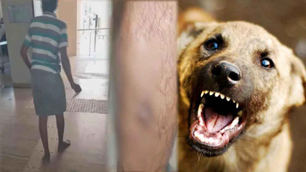  One person seriously injured after being bitten by a stray dog; tension in Thiruverkadu Photograph: (dog) 