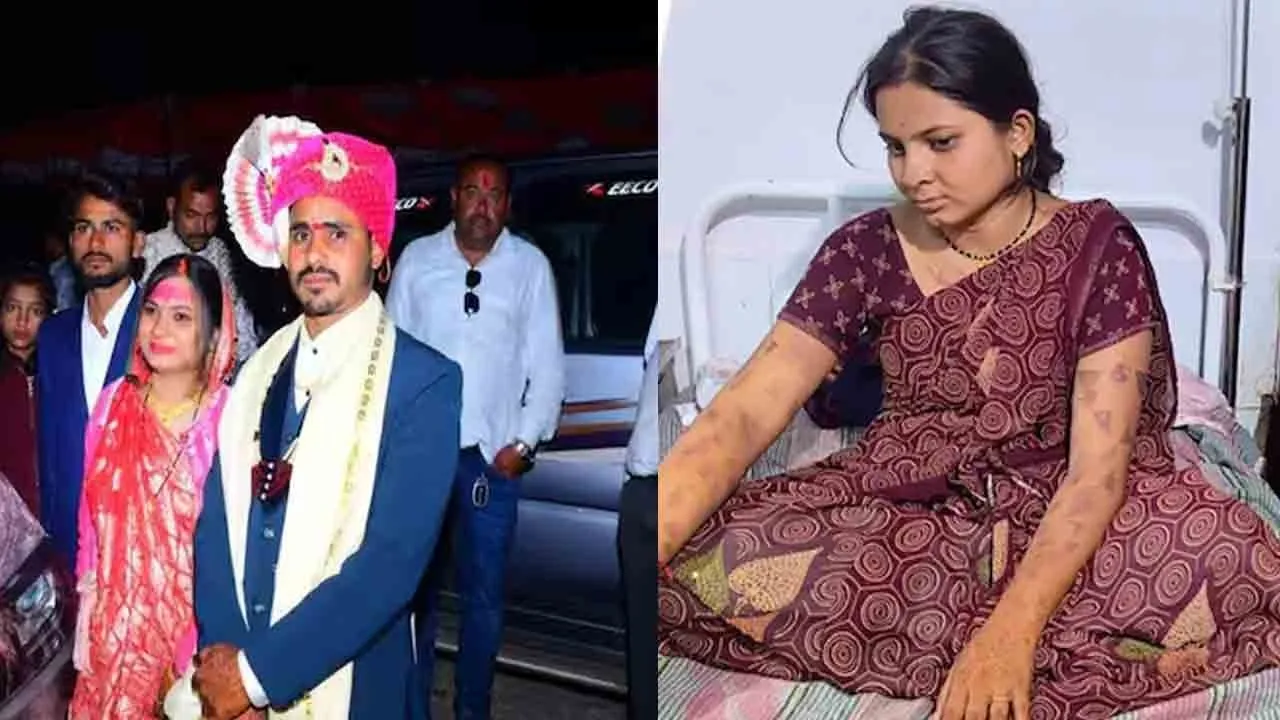  Husband ties up wife and burns her whole body cruelty unleashed over dowry in madhya pradesh 