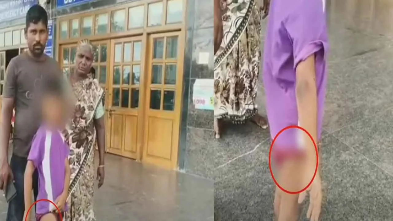  Stray dog ​​bites and mauls boy who went to the store Photograph: (thiruvallur) 