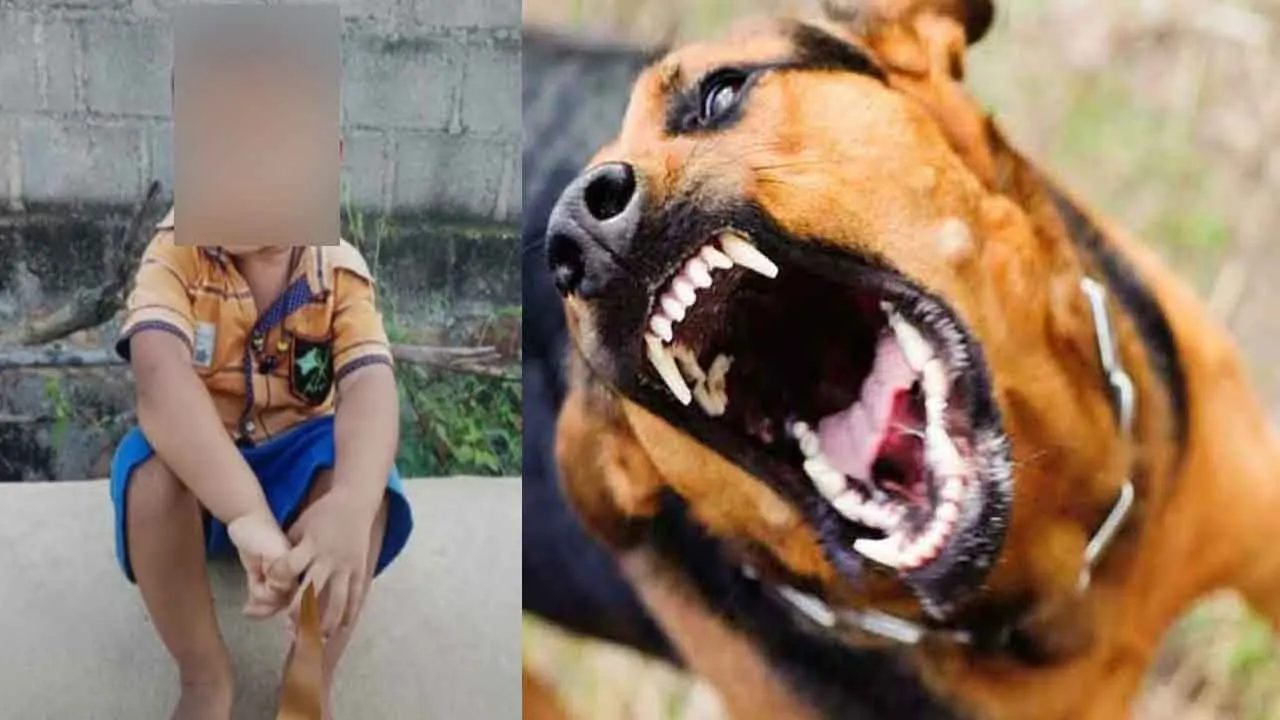  Stray dogs that took the life of a 4-year-old boy - a tragedy Photograph: (street dog) 