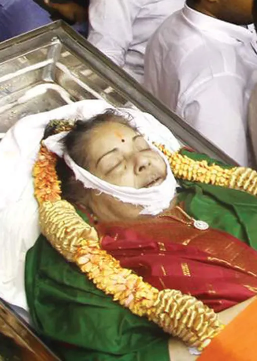  நாங்க சொன்னதை அப்பல்லோ கேட்கலை -எய்ம்ஸ் டாக்டர்கள்!