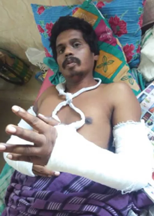  அம்பலமான ஊழல் கொலைவெறித் தாக்குதலில் சமூகப் போராளி!