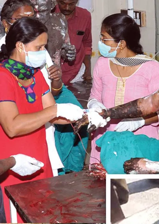  அலட்சியத்தால் எரிந்த 19 உயிர்கள்! கருகிச் சிதைந்த உடல்கள்!- தொடரும் கொடூரம்!