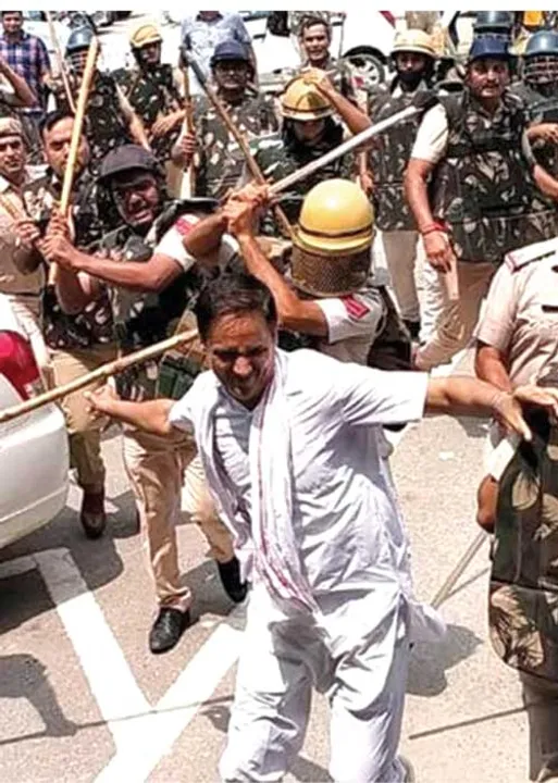  ஓயாத போராட்டம்! மண்டையை உடைத்த போலீஸ்!