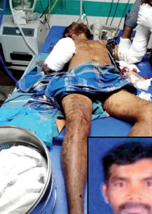  போலீஸ் இன்பார்மர் கையைத் துண்டித்த கொடூரம்!