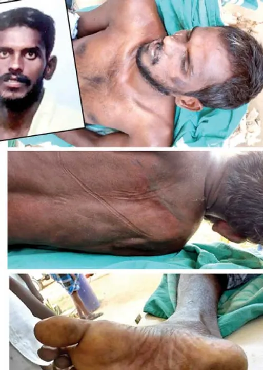  சந்தேக மரணம்..மூக்கிலும், ஆசன வாயிலும் மிளகாய்ப்பொடி.. சிக்கலில் ஈரோடு போலீஸார்!