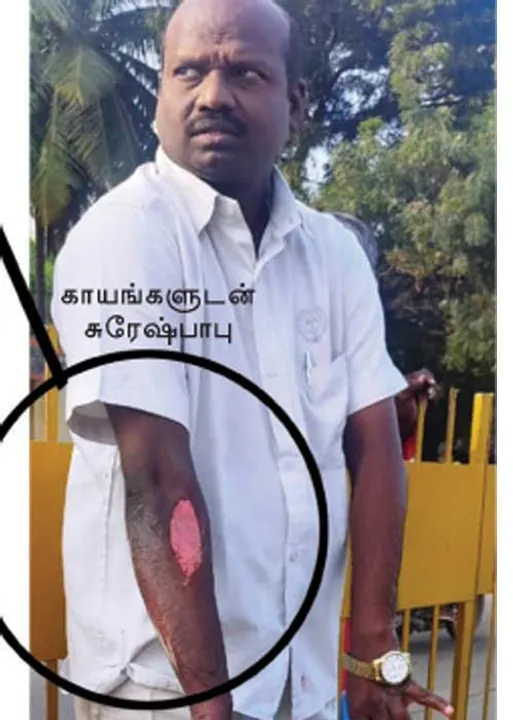  சமூக ஆர்வலர் மீது கொலை முயற்சி! -வேலூர் காவல்துறை அலட்சியம்!