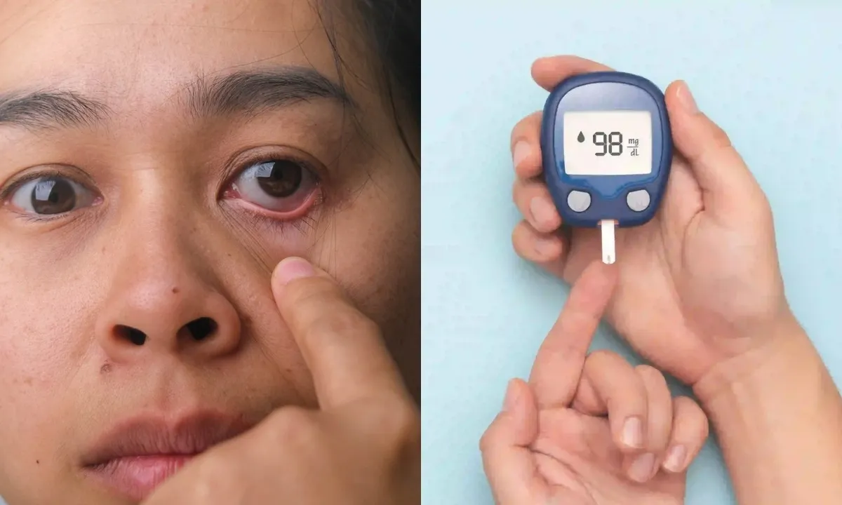 Diabetes Symptoms