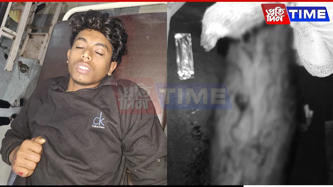 Guwahati: Burglar Snatches Gun, Tries to Flee; Shot by Police