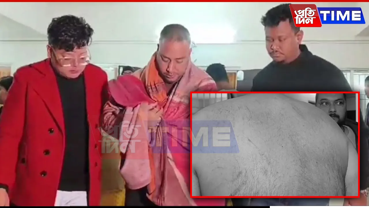 Assam Student Leader Assaulted by Group of Youths in Sivasagar
