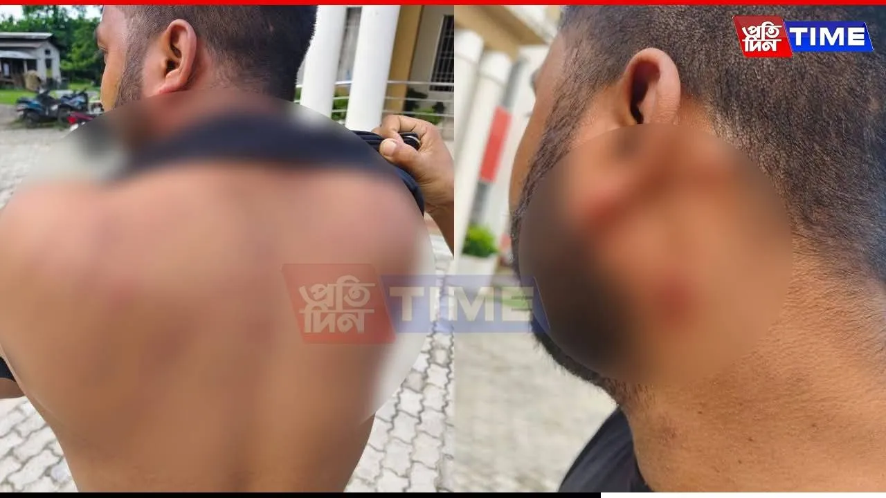 Journalist Attacked After Reaching Conflict Zone: Coincidence or Call?