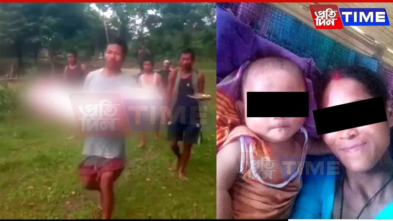 Japanese Encephalitis Claims Lives of Two Minors in Assam