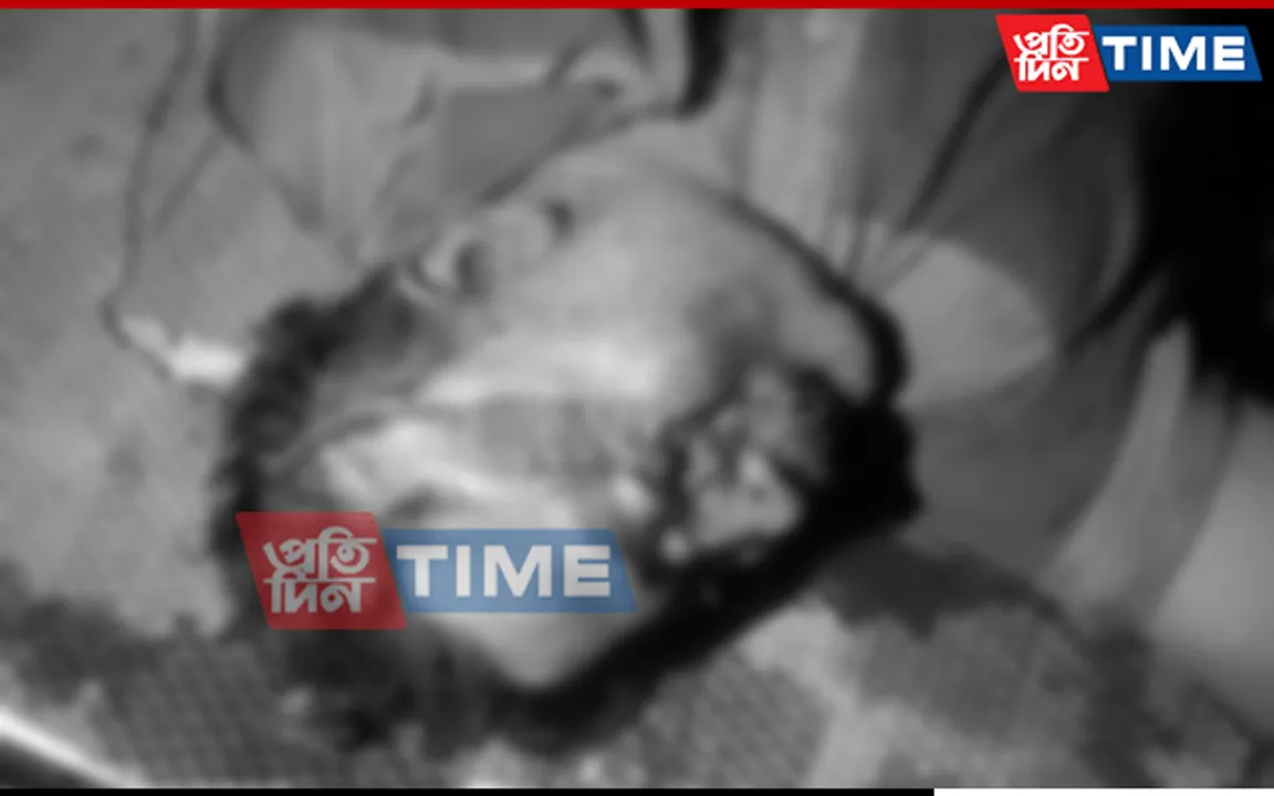 Guwahati: Body Of Man With Gash On Head Found In Basistha