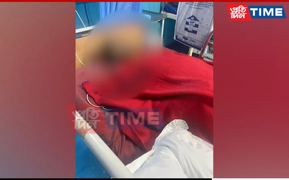 DU Ragging Case: Victim Anand Sharma Undergoes Another Surgery
