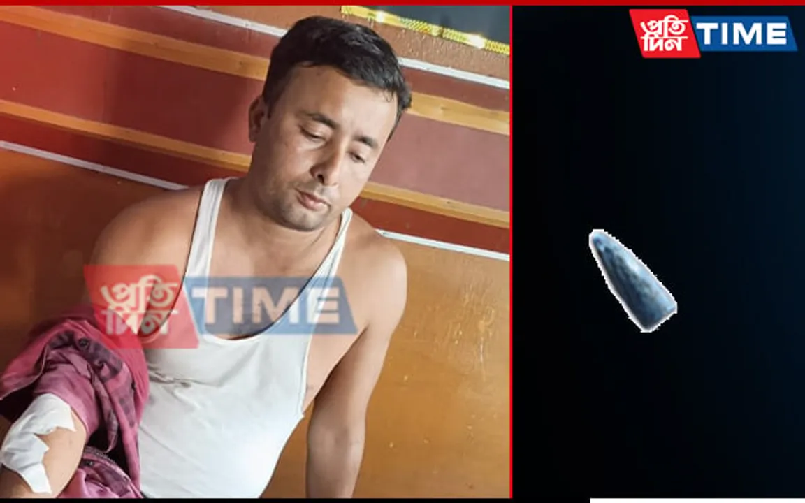 Guwahati: Man Allegedly Hit By Stray Bullet From Firing Range at Rani