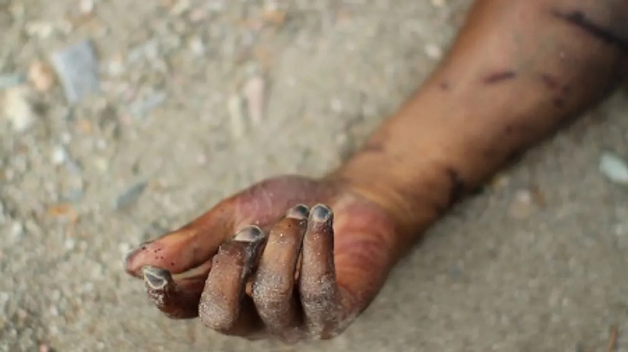 Boy electrocuted in Hailakandi