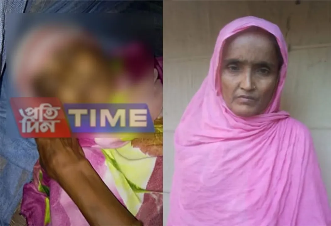 Sister dies after her sibling’s demise in Batadrava