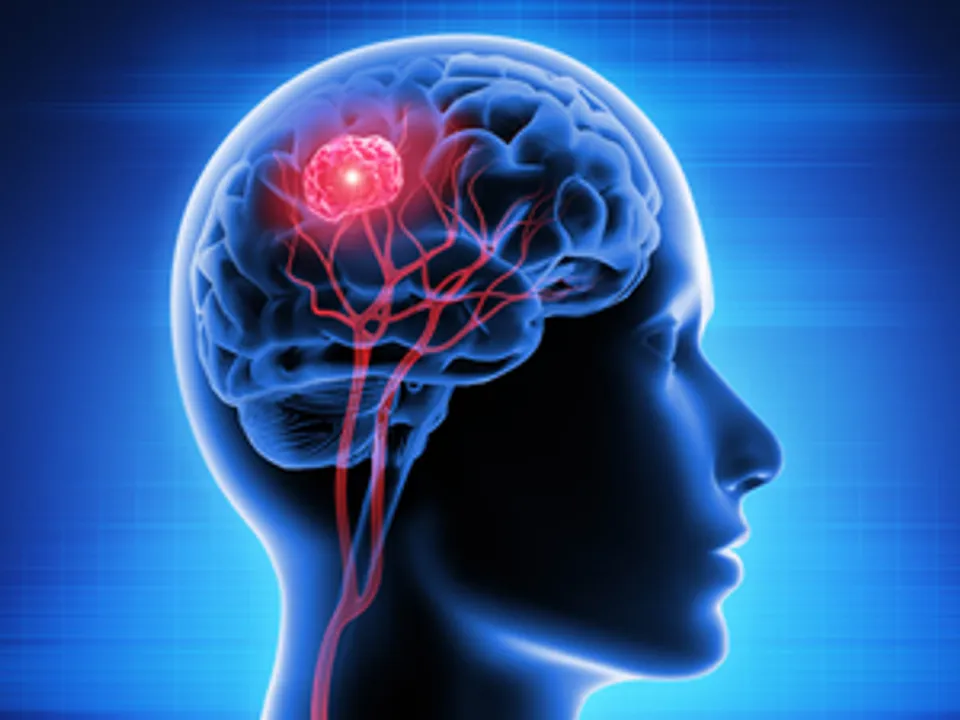  Key enzyme to fight deadly brain cancer identified