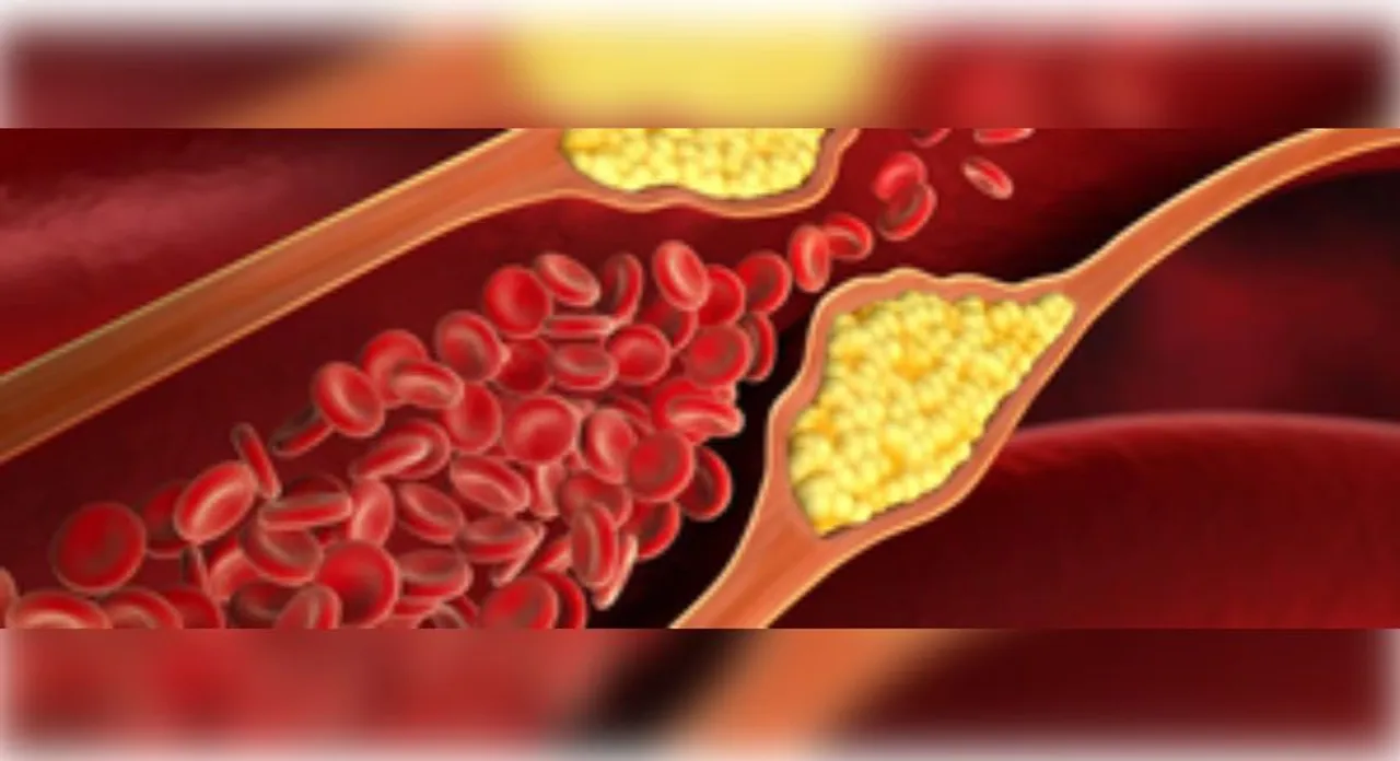  Indian scientists develop optical sensor for cholesterol detection