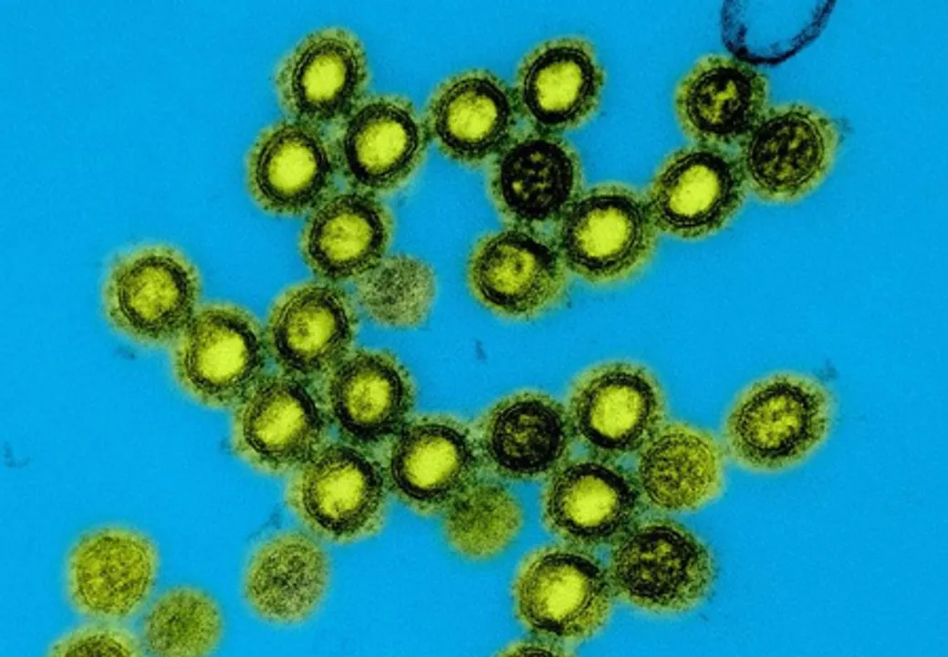  US launches next-generation universal vaccine platform for pandemic-prone viruses